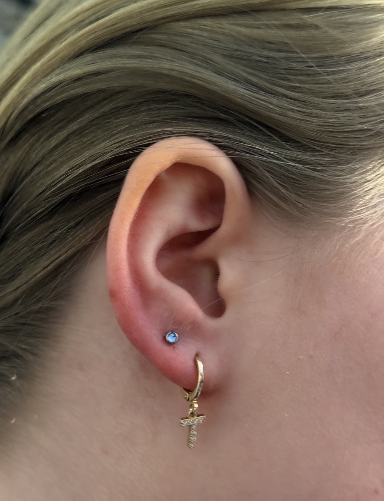 Lobe · stein