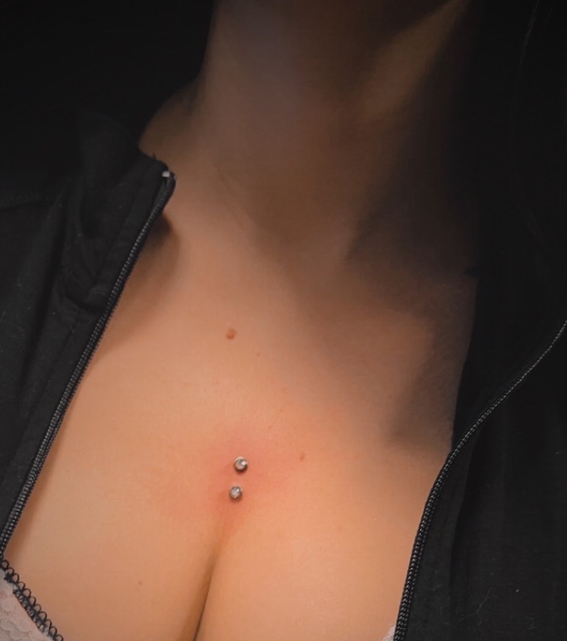 Bryst · surface