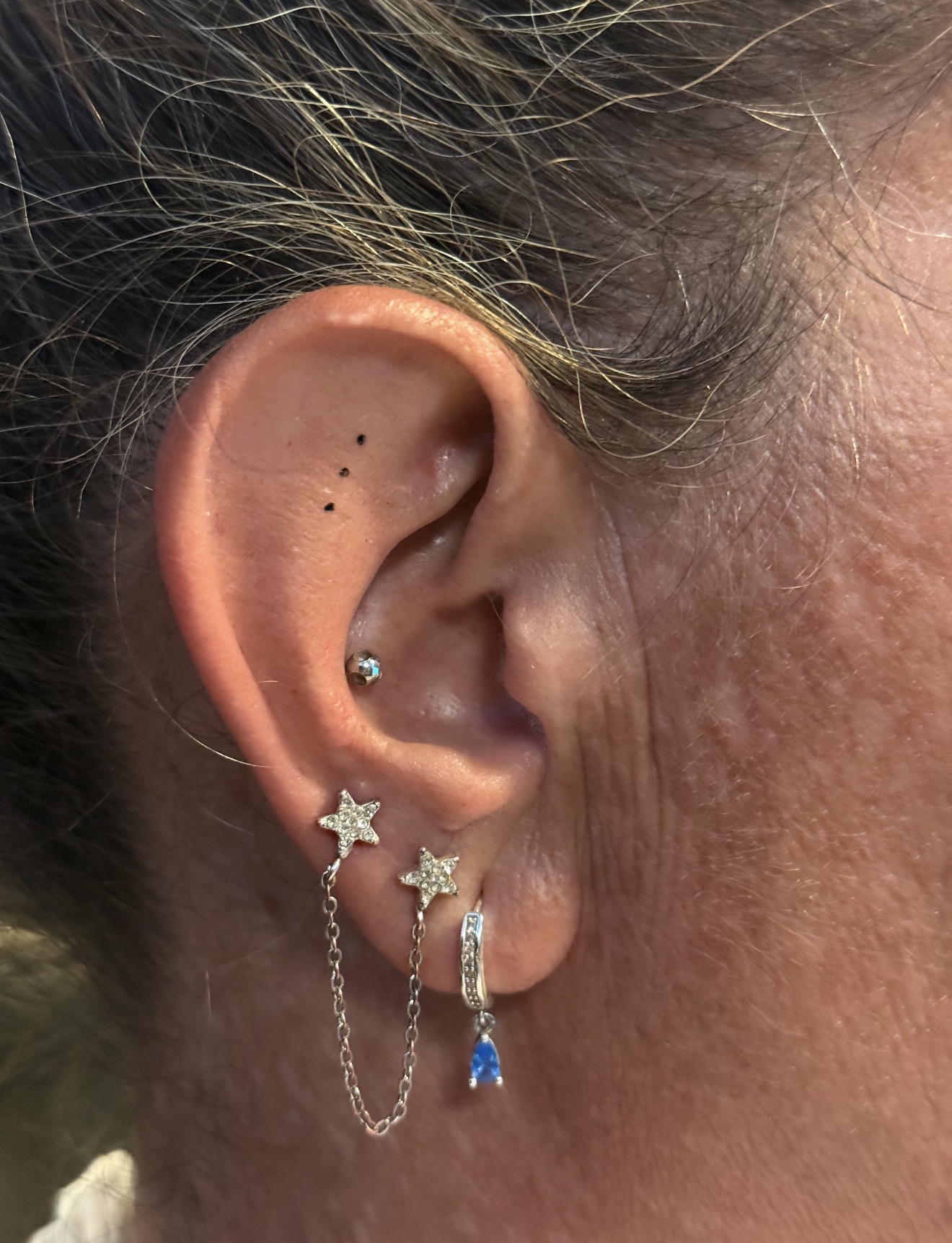 Tragus · solitær