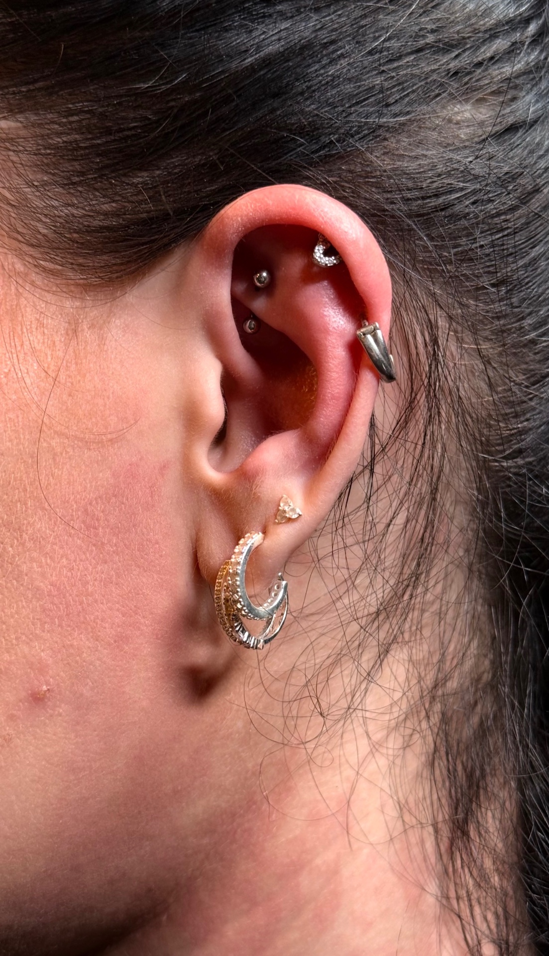 Snug & helix