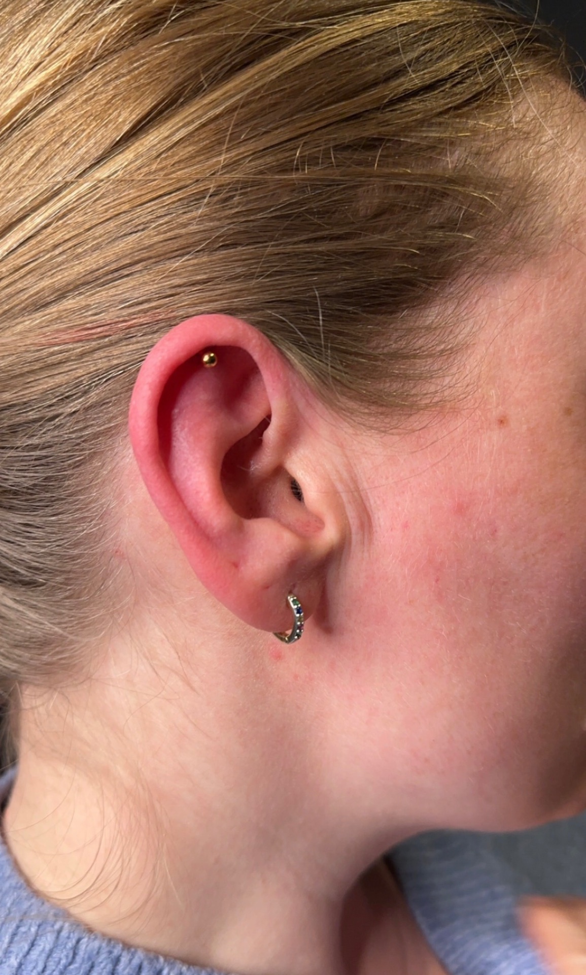 Helix · enkel